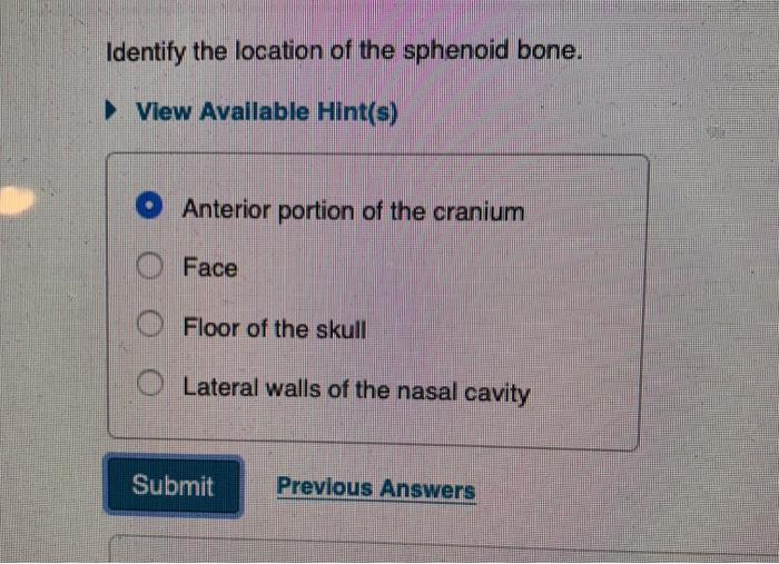 Identify the location of the sphenoid bone